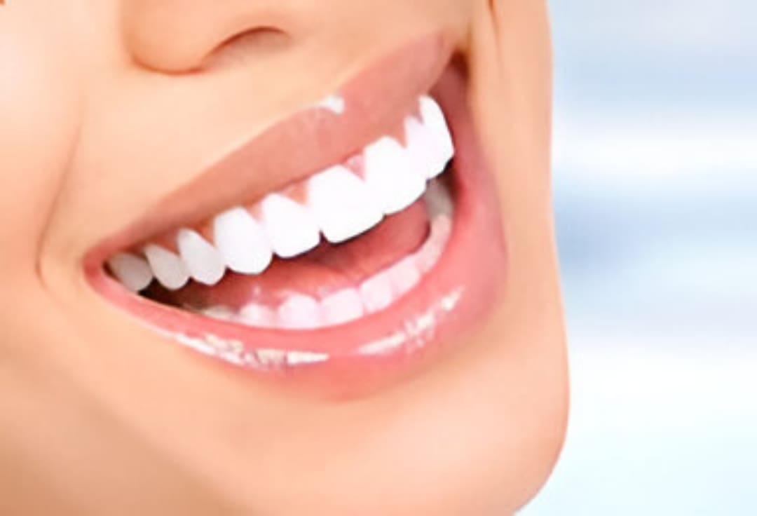 Clínica de implantes dentales